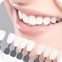 より美しい歯を目指す・ホワイトニング・白い詰め物（審美歯科）