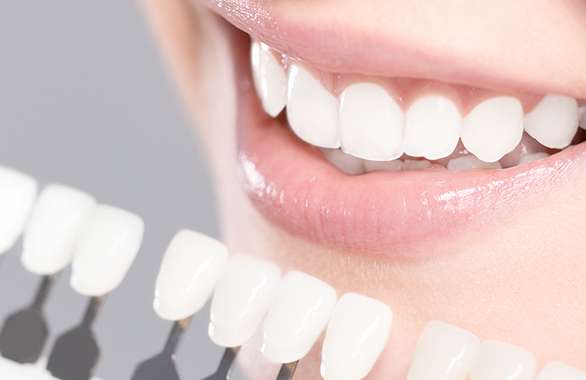 より美しい歯を目指す　ホワイトニング・白い詰め物（審美歯科）